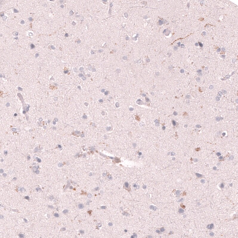 VMAT2 Antibody (CL13157) - Azide and BSA Free Immunohistochemistry-Paraffin: VMAT2 Antibody [NBP3-44388]