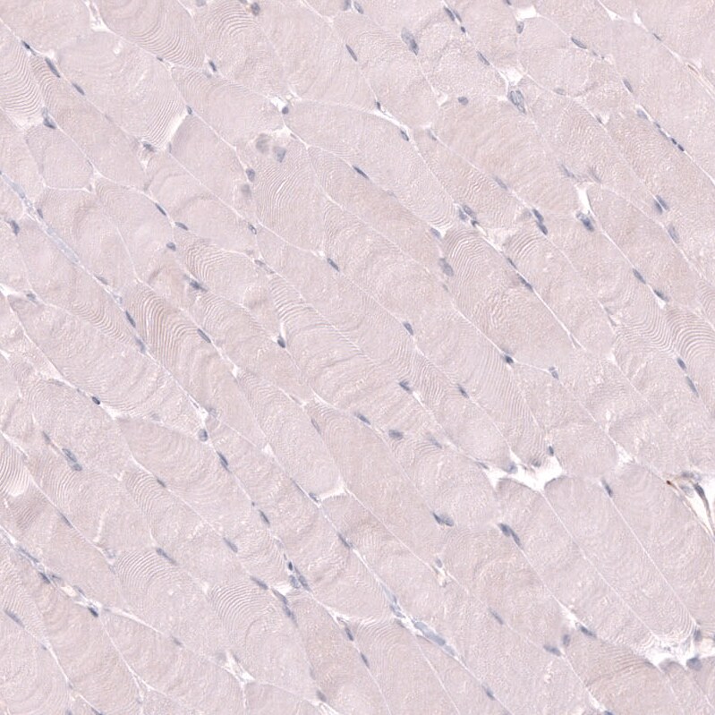 VMAT2 Antibody (CL13157) - Azide and BSA Free Immunohistochemistry-Paraffin: VMAT2 Antibody [NBP3-44388]