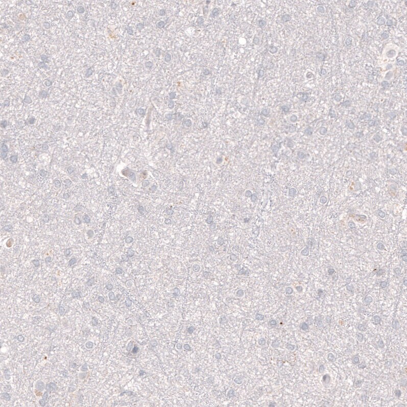 VMAT2 Antibody (CL12531) - Azide and BSA Free Immunohistochemistry-Paraffin: VMAT2 Antibody [NBP3-44389]