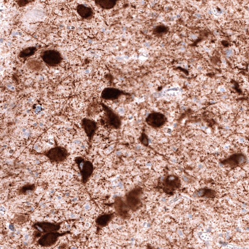 VMAT2 Antibody (CL12531) - Azide and BSA Free Immunohistochemistry-Paraffin: VMAT2 Antibody [NBP3-44389]