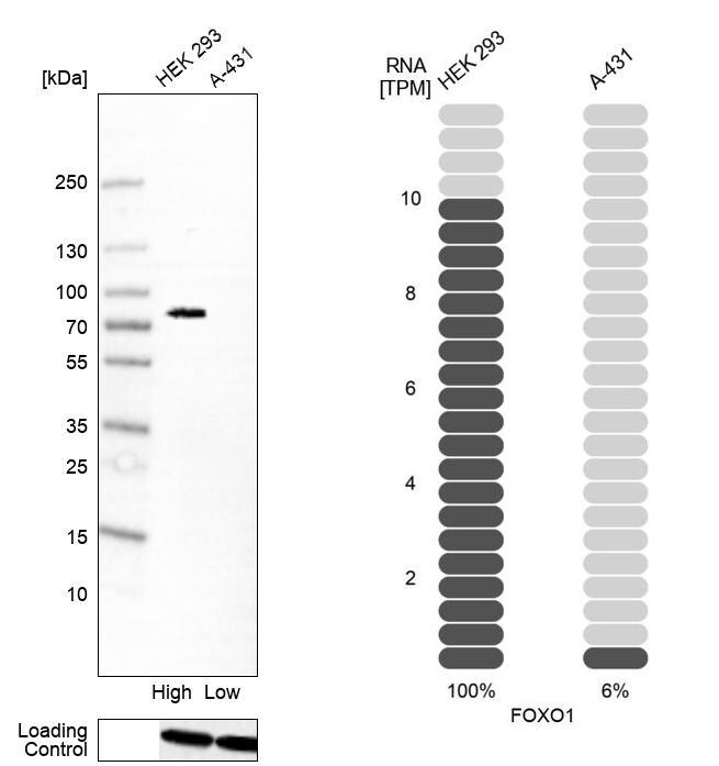 FoxO1/FKHR Antibody (CL13278) - Azide and BSA Free Western Blot: FoxO1/FKHR Antibody [NBP3-44390]