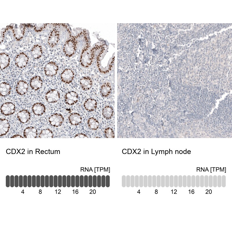 CDX2 Antibody (CL12974) - Azide and BSA Free Immunohistochemistry-Paraffin: CDX2 Antibody [NBP3-44391]