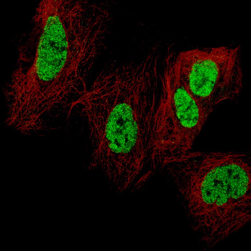 CDX2 Antibody (CL12974) - Azide and BSA Free Immunocytochemistry/ Immunofluorescence: CDX2 Antibody [NBP3-44391]