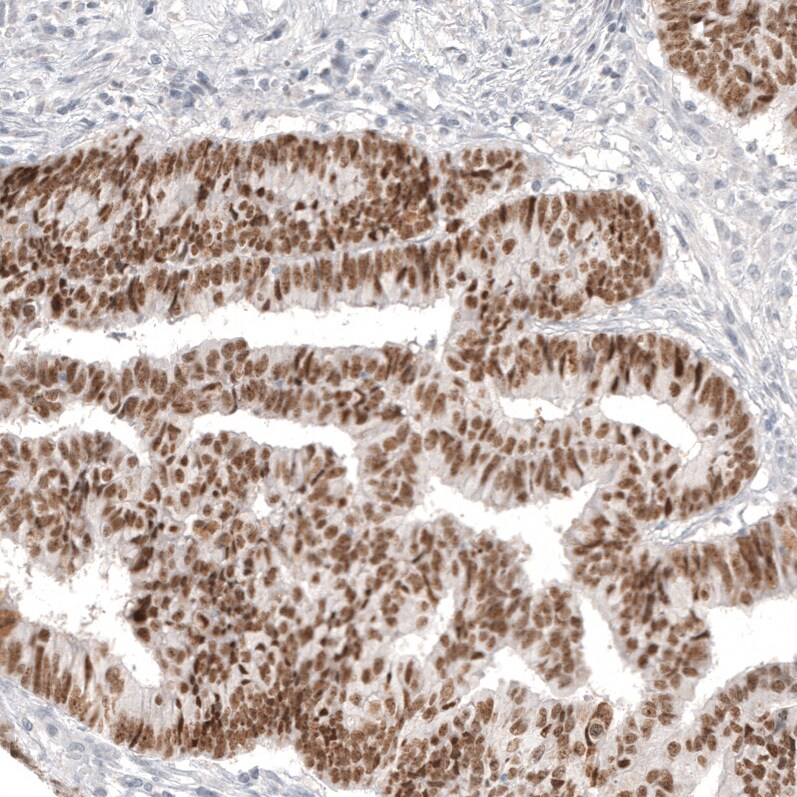 CDX2 Antibody (CL12974) - Azide and BSA Free Immunohistochemistry-Paraffin: CDX2 Antibody [NBP3-44391]