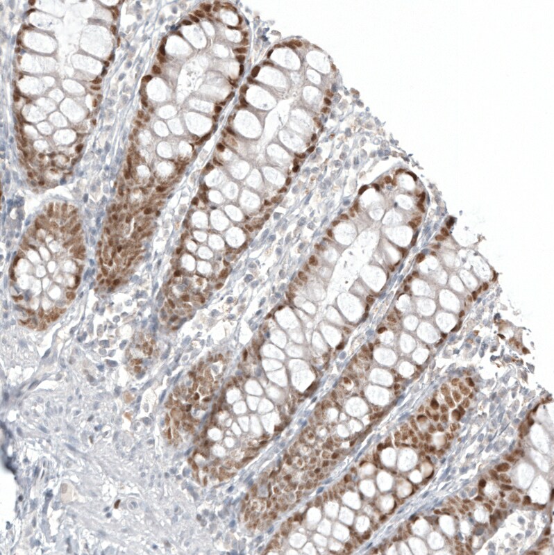 CDX2 Antibody (CL12974) - Azide and BSA Free Immunohistochemistry-Paraffin: CDX2 Antibody [NBP3-44391]