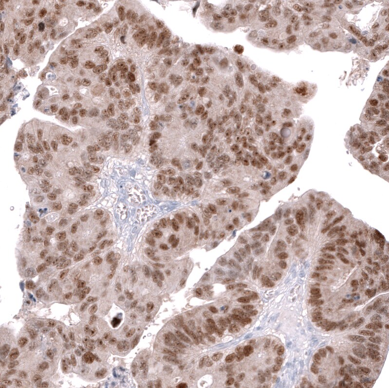CDX2 Antibody (CL12974) - Azide and BSA Free Immunohistochemistry-Paraffin: CDX2 Antibody [NBP3-44391]