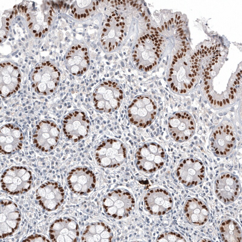 CDX2 Antibody (CL12974) - Azide and BSA Free Immunohistochemistry-Paraffin: CDX2 Antibody [NBP3-44391]