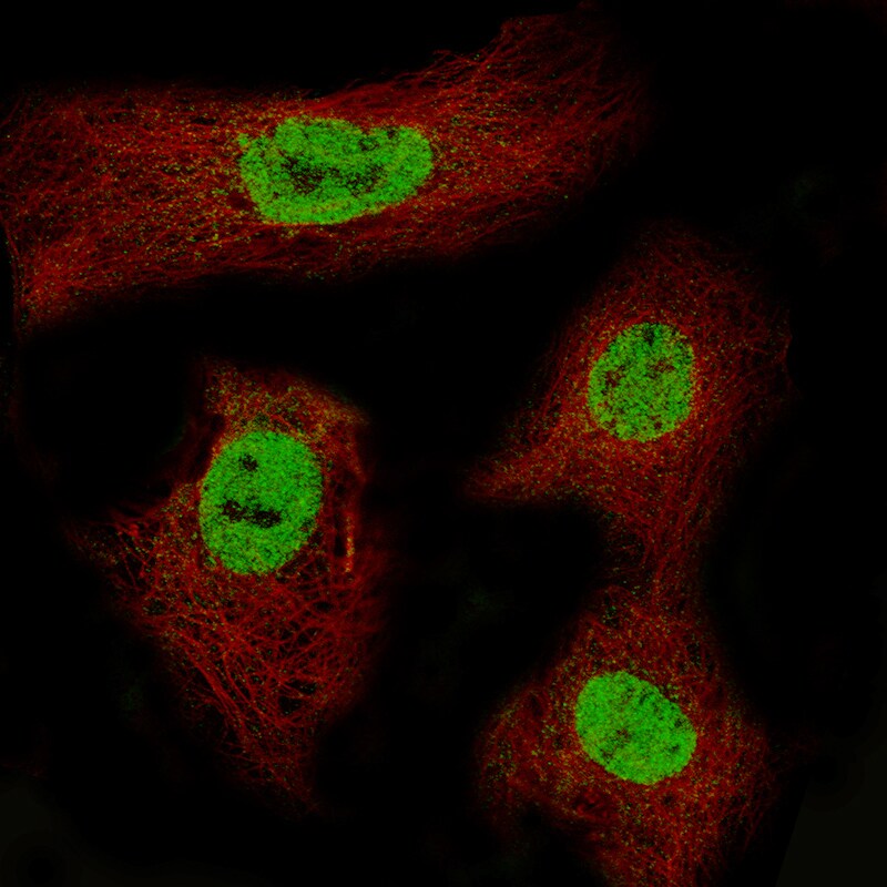 CDX2 Antibody (CL12967) - Azide and BSA Free Immunocytochemistry/ Immunofluorescence: CDX2 Antibody [NBP3-44392]