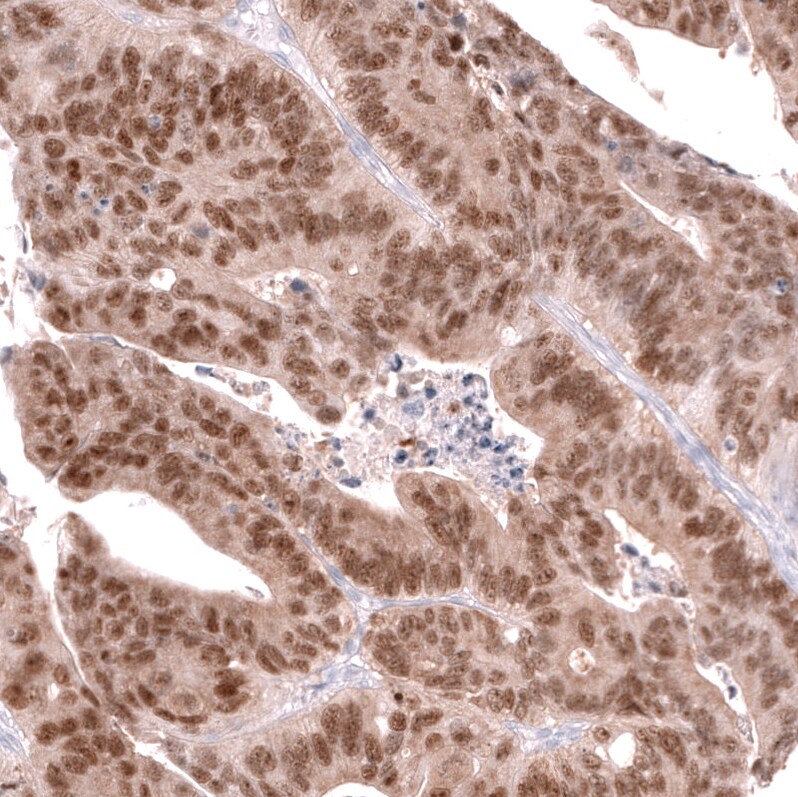 CDX2 Antibody (CL12967) - Azide and BSA Free Immunohistochemistry-Paraffin: CDX2 Antibody [NBP3-44392]