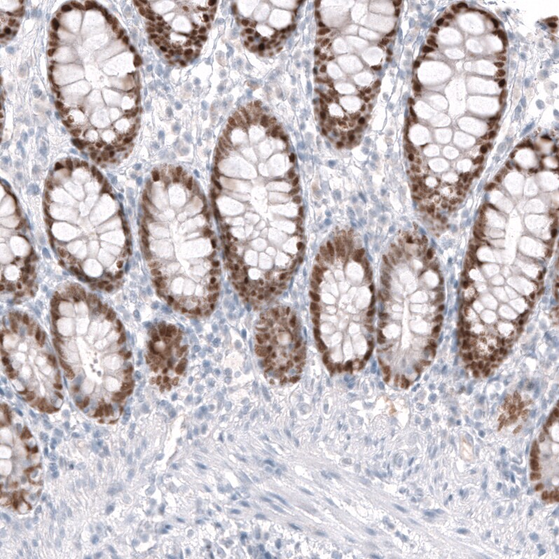CDX2 Antibody (CL12967) - Azide and BSA Free Immunohistochemistry-Paraffin: CDX2 Antibody [NBP3-44392]