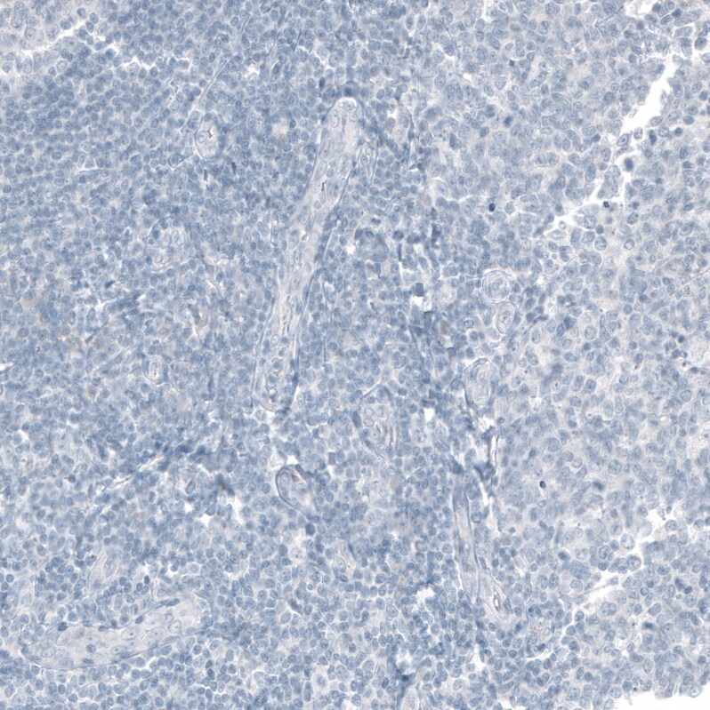 CDX2 Antibody (CL12967) - Azide and BSA Free Immunohistochemistry-Paraffin: CDX2 Antibody [NBP3-44392]