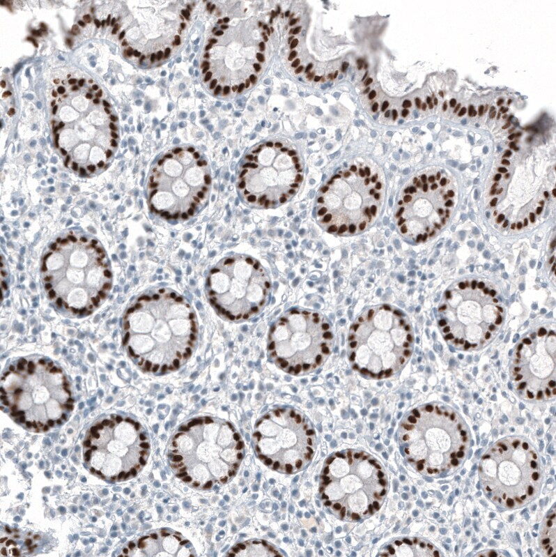 CDX2 Antibody (CL12967) - Azide and BSA Free Immunohistochemistry-Paraffin: CDX2 Antibody [NBP3-44392]