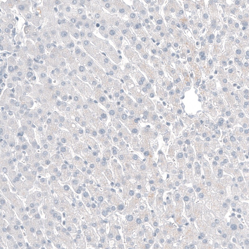 CDX2 Antibody (CL12967) - Azide and BSA Free Immunohistochemistry-Paraffin: CDX2 Antibody [NBP3-44392]