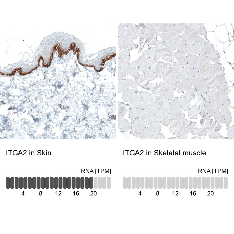 Integrin alpha 2/CD49b Antibody (CL7318) - Azide and BSA Free Immunohistochemistry-Paraffin: Integrin alpha 2/CD49b Antibody [NBP3-44393]