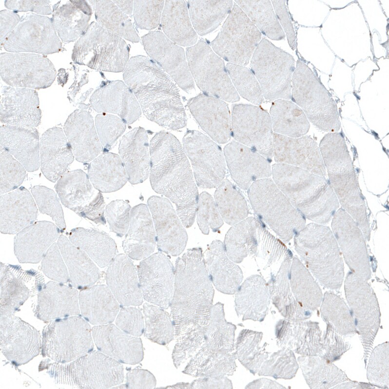 Integrin alpha 2/CD49b Antibody (CL7318) - Azide and BSA Free Immunohistochemistry-Paraffin: Integrin alpha 2/CD49b Antibody [NBP3-44393]