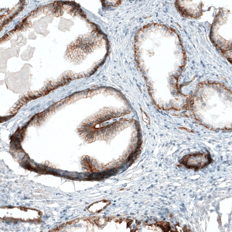 Integrin alpha 2/CD49b Antibody (CL7318) - Azide and BSA Free Immunohistochemistry-Paraffin: Integrin alpha 2/CD49b Antibody [NBP3-44393]