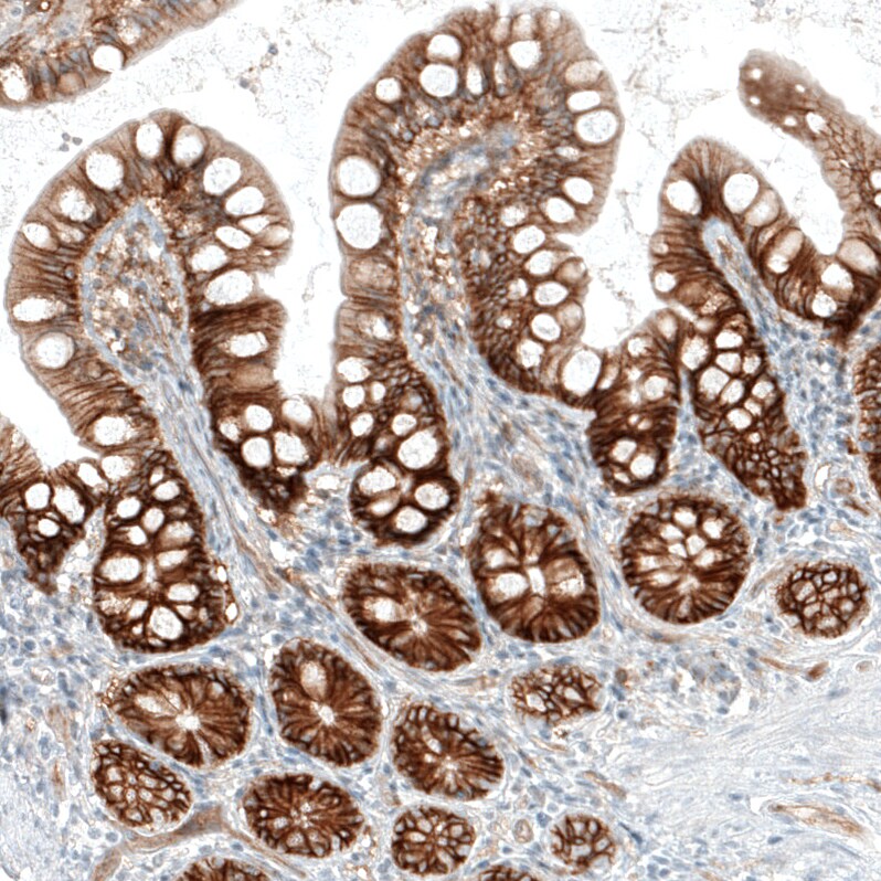 Integrin alpha 2/CD49b Antibody (CL7318) - Azide and BSA Free Immunohistochemistry-Paraffin: Integrin alpha 2/CD49b Antibody [NBP3-44393]