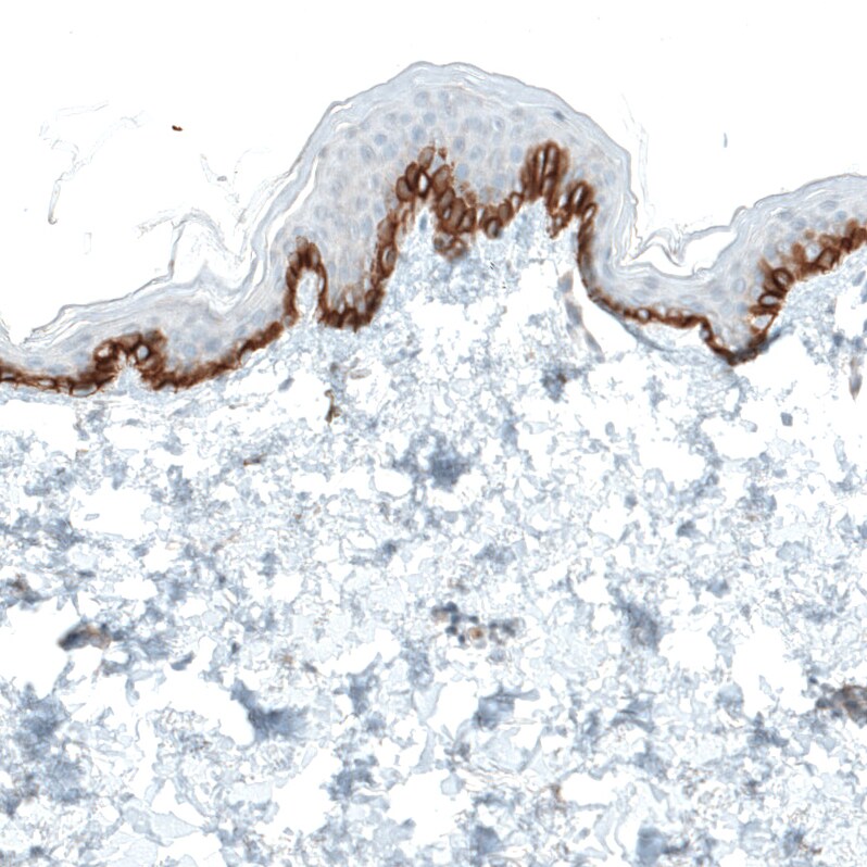 Integrin alpha 2/CD49b Antibody (CL7318) - Azide and BSA Free Immunohistochemistry-Paraffin: Integrin alpha 2/CD49b Antibody [NBP3-44393]
