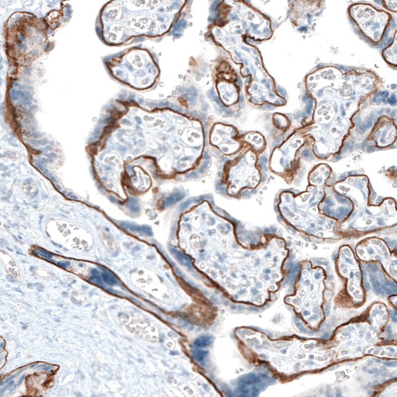 Integrin alpha 6/CD49f Antibody (CL6957) - Azide and BSA Free Immunohistochemistry-Paraffin: Integrin alpha 6/CD49f Antibody [NBP3-44394]