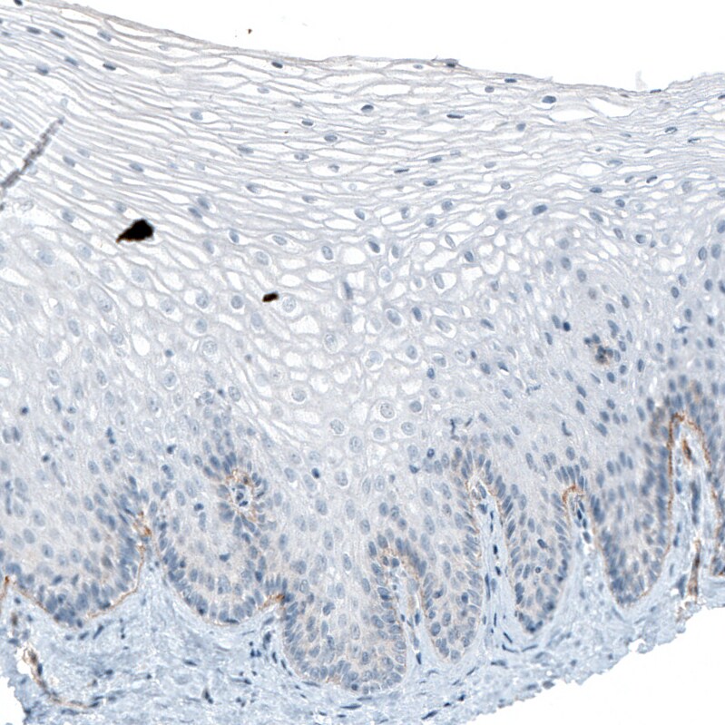 Integrin alpha 6/CD49f Antibody (CL6957) - Azide and BSA Free Immunohistochemistry-Paraffin: Integrin alpha 6/CD49f Antibody [NBP3-44394]