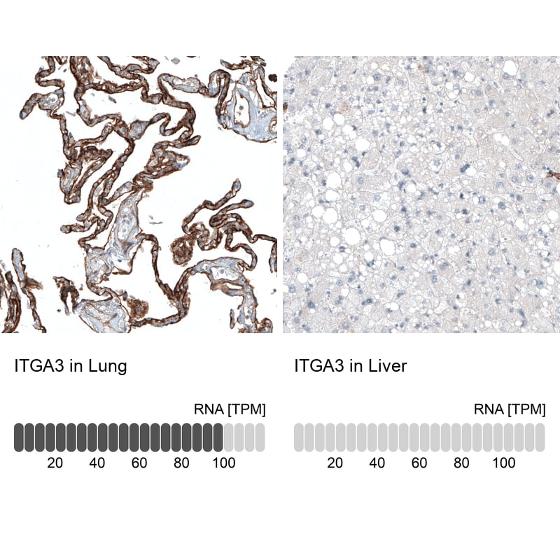 Integrin alpha 3/CD49c Antibody (CL6937) - Azide and BSA Free Immunohistochemistry-Paraffin: Integrin alpha 3/CD49c Antibody [NBP3-44395]