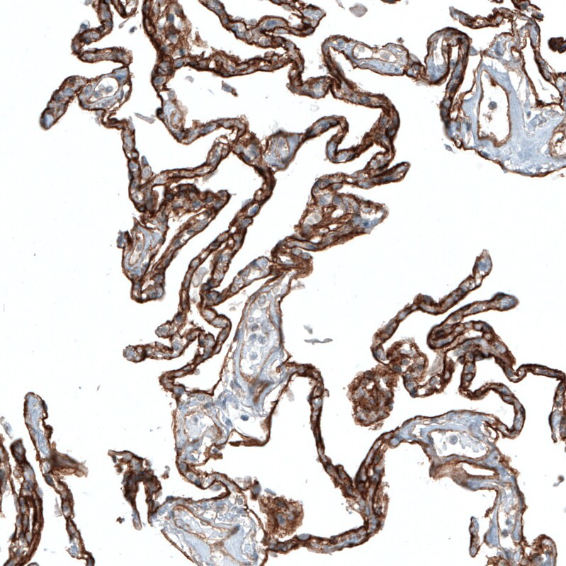 Integrin alpha 3/CD49c Antibody (CL6937) - Azide and BSA Free Immunohistochemistry-Paraffin: Integrin alpha 3/CD49c Antibody [NBP3-44395]