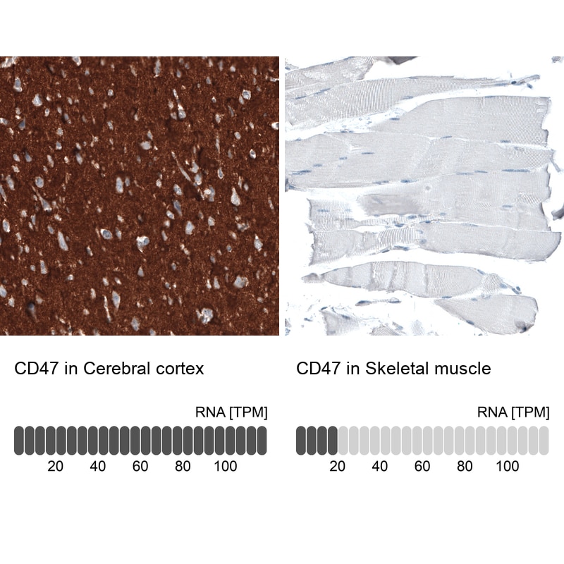 CD47 Antibody (CL6913) - Azide and BSA Free Immunohistochemistry-Paraffin: CD47 Antibody [NBP3-44397]