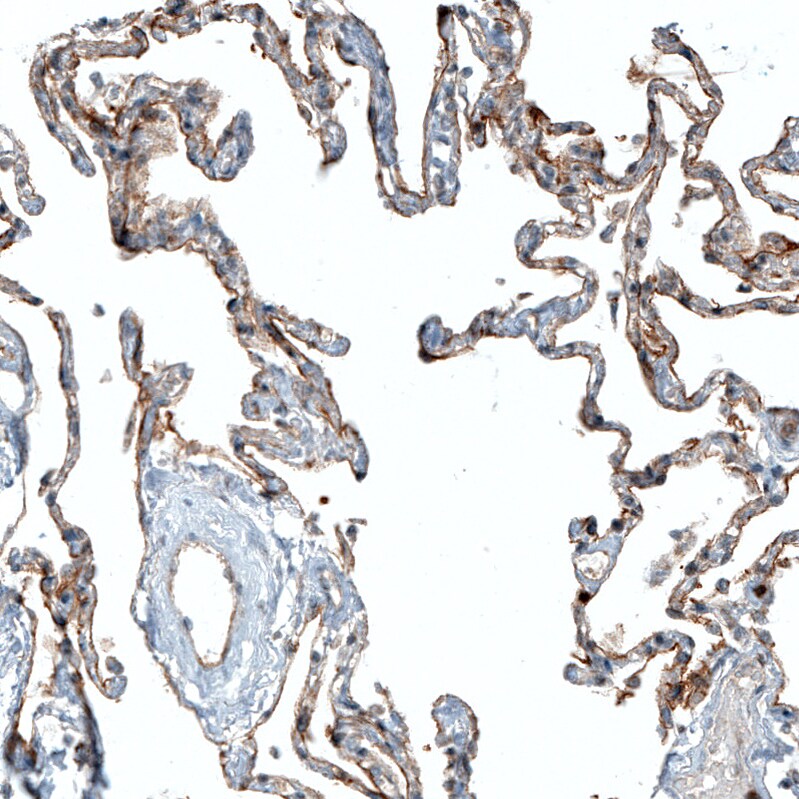 CD47 Antibody (CL6913) - Azide and BSA Free Immunohistochemistry-Paraffin: CD47 Antibody [NBP3-44397]