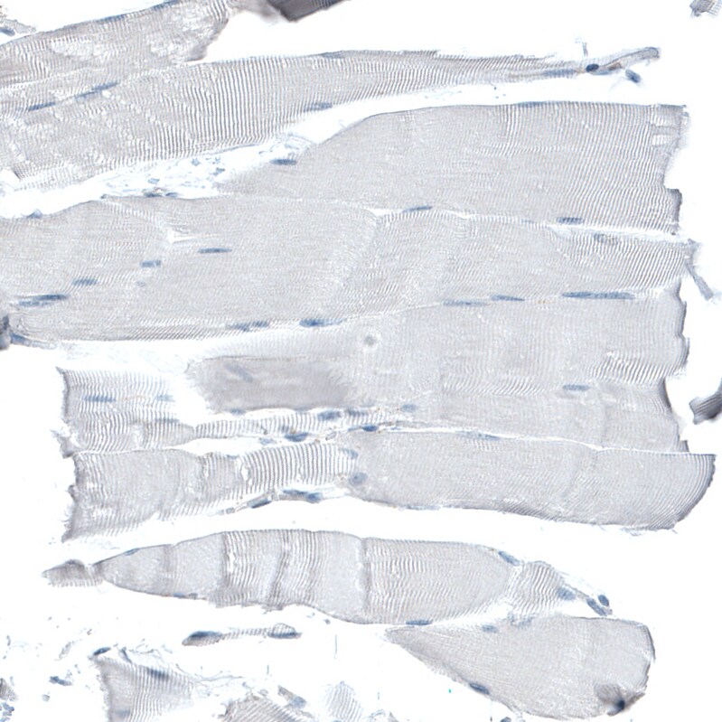 CD47 Antibody (CL6913) - Azide and BSA Free Immunohistochemistry-Paraffin: CD47 Antibody [NBP3-44397]