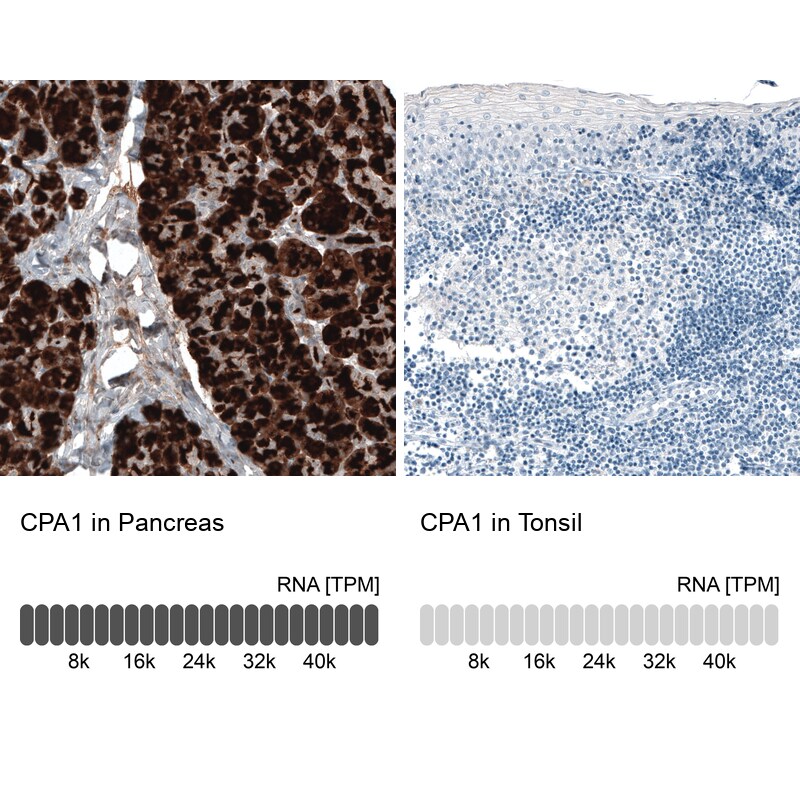 Carboxypeptidase A1/CPA1 Antibody (CL6607) - Azide and BSA Free Immunohistochemistry-Paraffin: Carboxypeptidase A1/CPA1 Antibody [NBP3-44398]