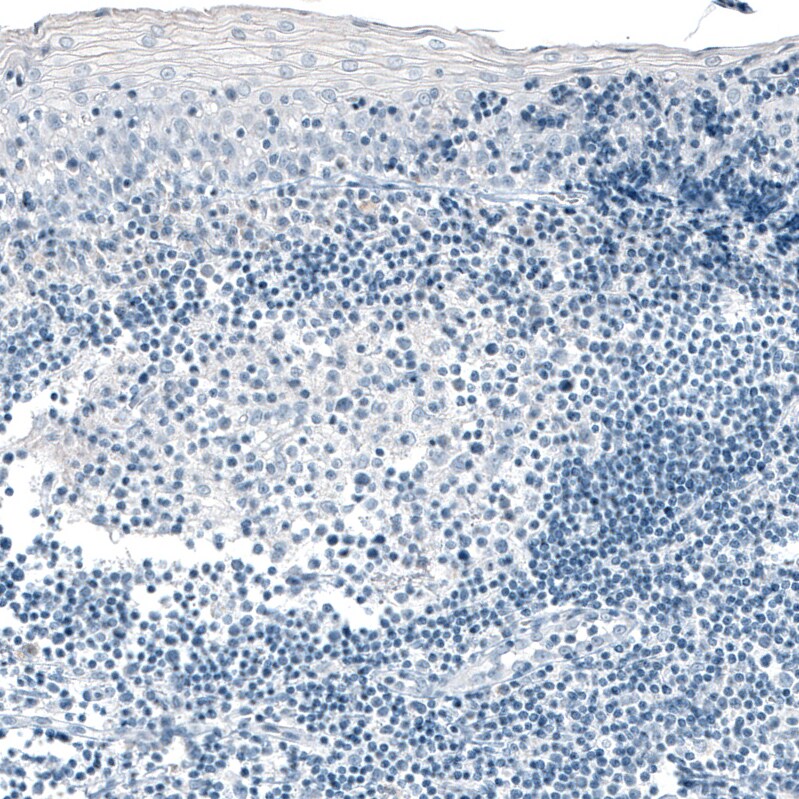 Carboxypeptidase A1/CPA1 Antibody (CL6607) - Azide and BSA Free Immunohistochemistry-Paraffin: Carboxypeptidase A1/CPA1 Antibody [NBP3-44398]