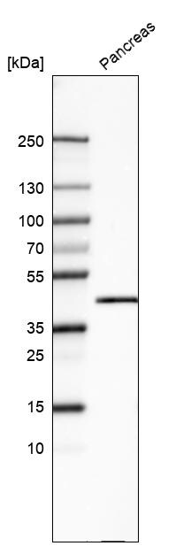 Carboxypeptidase A1/CPA1 Antibody (CL6629) - Azide and BSA Free Western Blot: Carboxypeptidase A1/CPA1 Antibody [NBP3-44399]