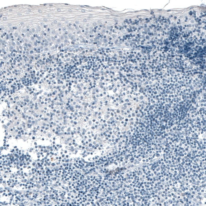 Carboxypeptidase A1/CPA1 Antibody (CL6629) - Azide and BSA Free Immunohistochemistry-Paraffin: Carboxypeptidase A1/CPA1 Antibody [NBP3-44399]