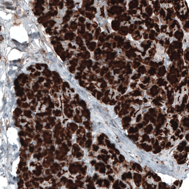 Carboxypeptidase A1/CPA1 Antibody (CL6629) - Azide and BSA Free Immunohistochemistry-Paraffin: Carboxypeptidase A1/CPA1 Antibody [NBP3-44399]
