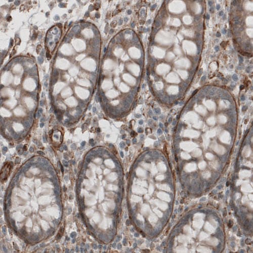 Laminin S/Laminin beta 2 Antibody (CL2976) - Azide and BSA Free Immunohistochemistry-Paraffin: Laminin S/Laminin beta 2 Antibody [NBP3-44400]