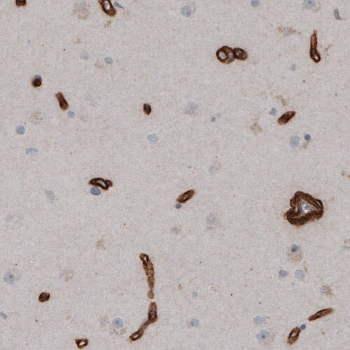 Laminin S/Laminin beta 2 Antibody (CL2976) - Azide and BSA Free Immunohistochemistry-Paraffin: Laminin S/Laminin beta 2 Antibody [NBP3-44400]