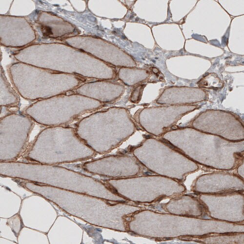 Laminin S/Laminin beta 2 Antibody (CL2976) - Azide and BSA Free Immunohistochemistry-Paraffin: Laminin S/Laminin beta 2 Antibody [NBP3-44400]