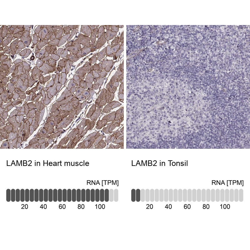 Laminin S/Laminin beta 2 Antibody (CL2979) - Azide and BSA Free Immunohistochemistry-Paraffin: Laminin S/Laminin beta 2 Antibody [NBP3-44401]
