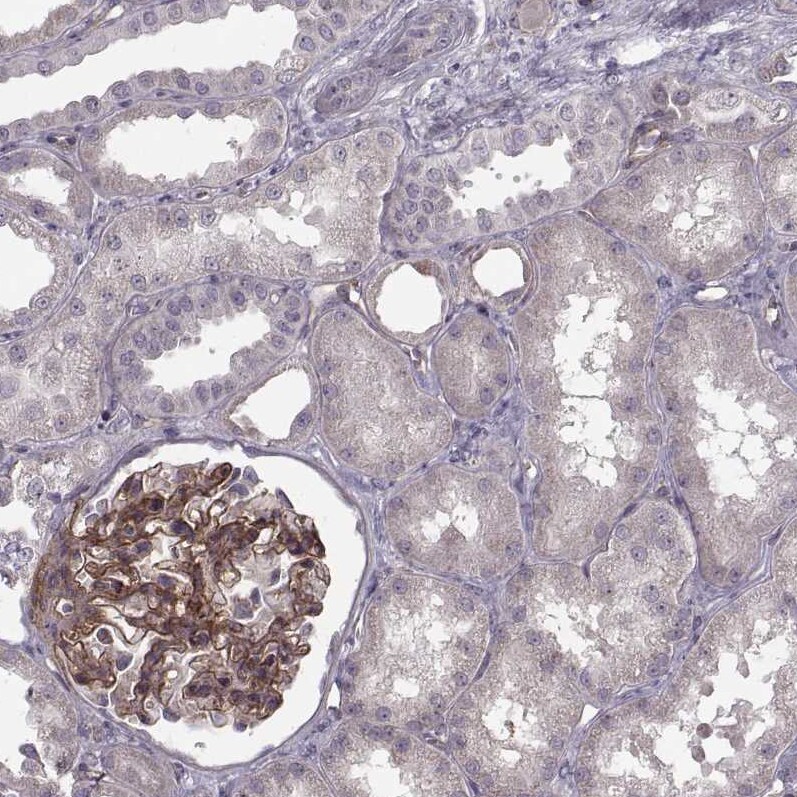 Laminin S/Laminin beta 2 Antibody (CL2979) - Azide and BSA Free Immunohistochemistry-Paraffin: Laminin S/Laminin beta 2 Antibody [NBP3-44401]