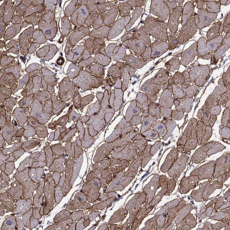 Laminin S/Laminin beta 2 Antibody (CL2979) - Azide and BSA Free Immunohistochemistry-Paraffin: Laminin S/Laminin beta 2 Antibody [NBP3-44401]