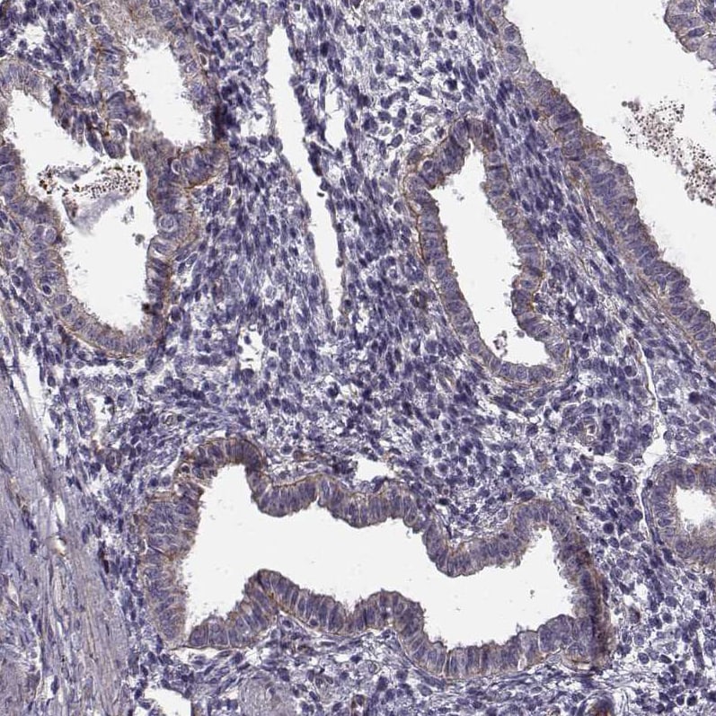Laminin S/Laminin beta 2 Antibody (CL2979) - Azide and BSA Free Immunohistochemistry-Paraffin: Laminin S/Laminin beta 2 Antibody [NBP3-44401]