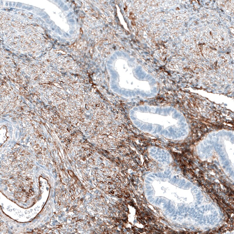 Integrin alpha 5/CD49e Antibody (CL6940) - Azide and BSA Free Immunohistochemistry-Paraffin: Integrin alpha 5/CD49e Antibody [NBP3-44402]