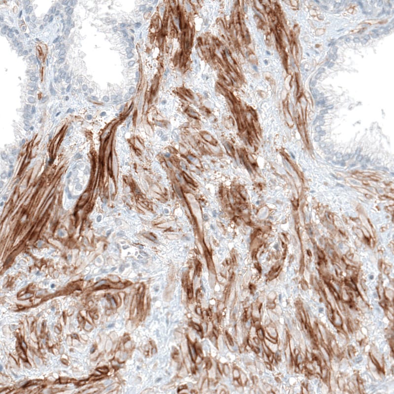 Integrin alpha 5/CD49e Antibody (CL6945) - Azide and BSA Free Immunohistochemistry-Paraffin: Integrin alpha 5/CD49e Antibody [NBP3-44403]