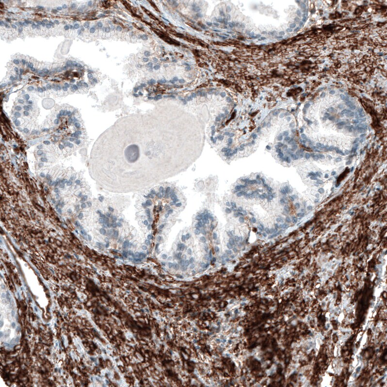 Integrin alpha 5/CD49e Antibody (CL6951) - Azide and BSA Free Immunohistochemistry-Paraffin: Integrin alpha 5/CD49e Antibody [NBP3-44404]