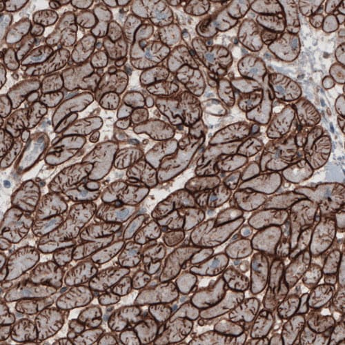 Laminin gamma 1 Antibody (CL3196) - Azide and BSA Free Immunohistochemistry-Paraffin: Laminin gamma 1 Antibody [NBP3-44405]