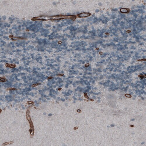 Laminin gamma 1 Antibody (CL3195) - Azide and BSA Free Immunohistochemistry-Paraffin: Laminin gamma 1 Antibody [NBP3-44406]