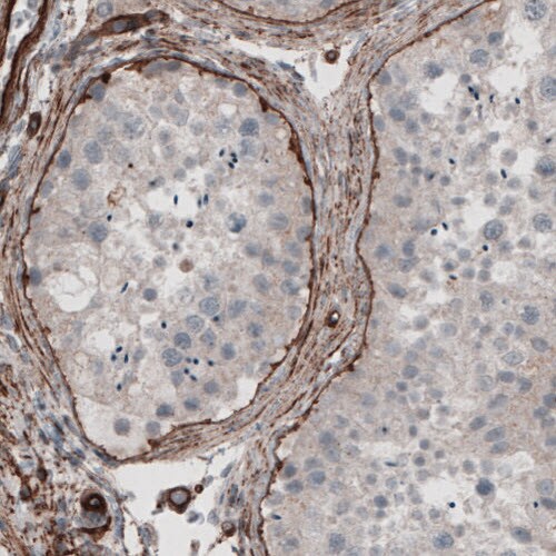 Laminin gamma 1 Antibody (CL3195) - Azide and BSA Free Immunohistochemistry-Paraffin: Laminin gamma 1 Antibody [NBP3-44406]