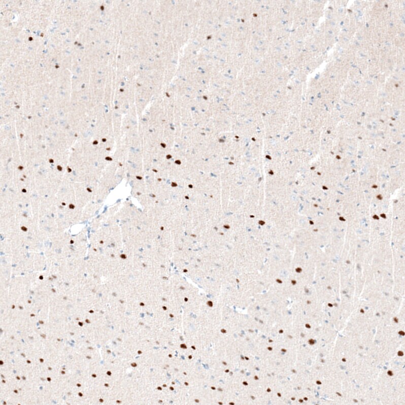 BCL11B Antibody (CL6426) - Azide and BSA Free Immunohistochemistry-Paraffin: BCL11B Antibody [NBP3-44407]