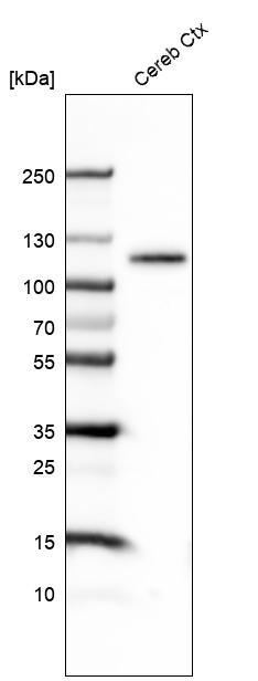 BCL11B Antibody (CL6426) - Azide and BSA Free Western Blot: BCL11B Antibody [NBP3-44407]