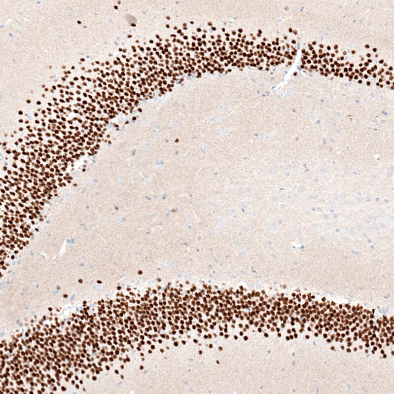 BCL11B Antibody (CL6426) - Azide and BSA Free Immunohistochemistry-Paraffin: BCL11B Antibody [NBP3-44407]